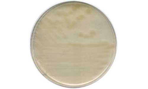 R2A Agar