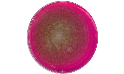 Rose-Bengal Chloramphenicol Agar (RBC)