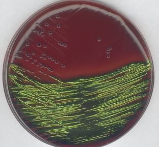 EMB agar