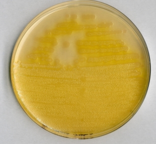 Pseudomonas agar F (base)