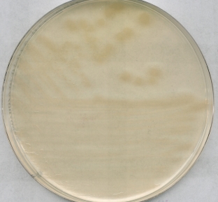 R2A Agar