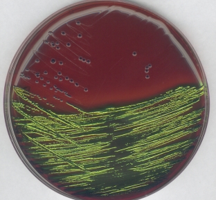 محیط کشت میکروبی  emb-agar EMB agar