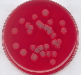 Blood agar (base)