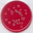 Blood agar (base)